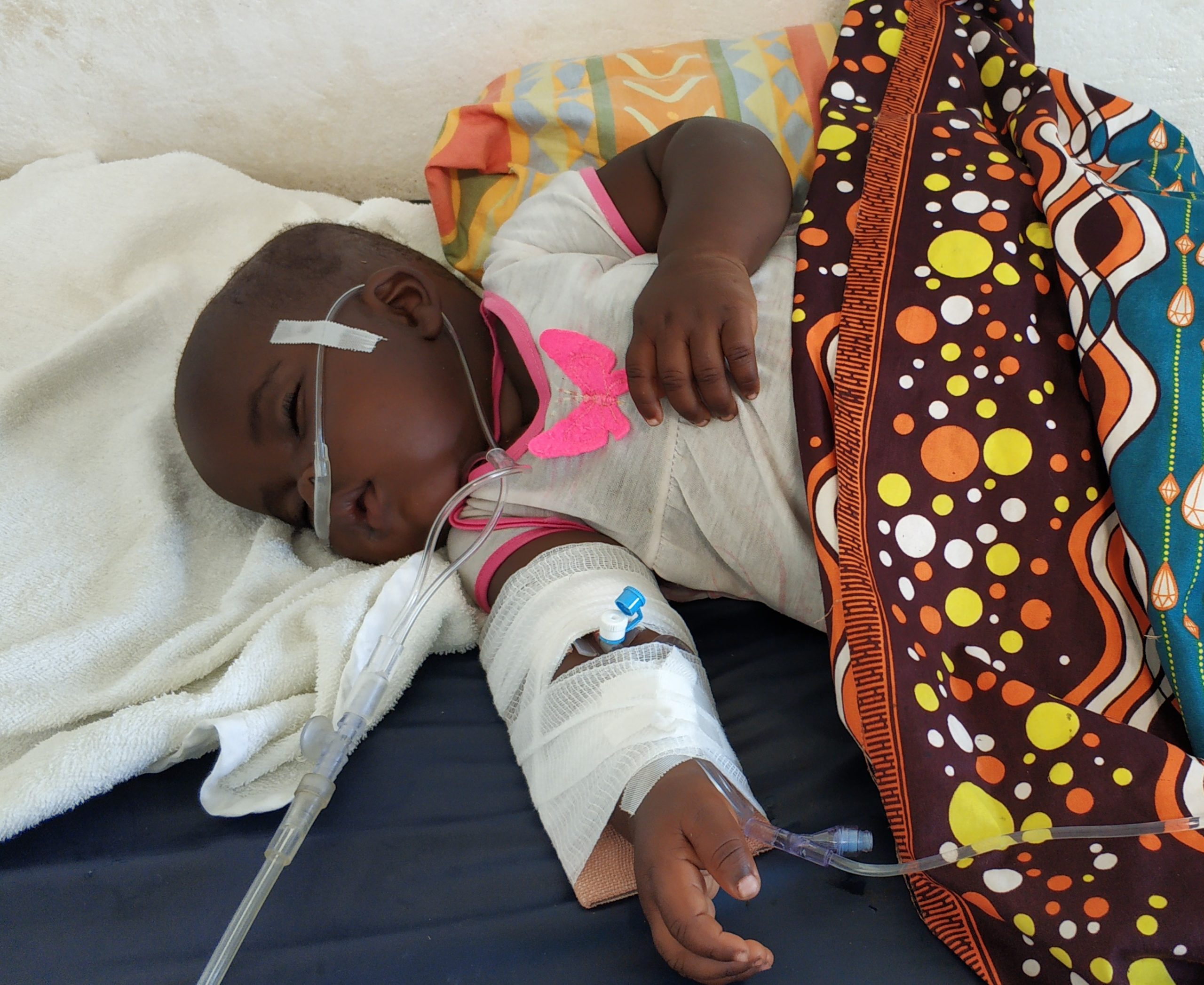 A toddler unconscious due to severe malaria